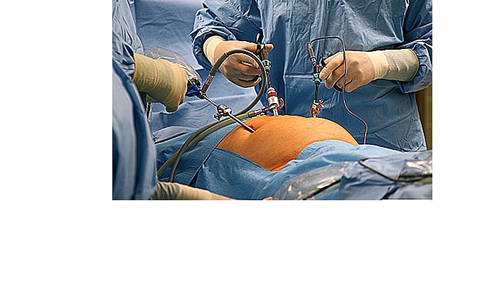 Laparoskopik Cerrahi Uygulamaları ile İyileşme Süresi Kısaldı